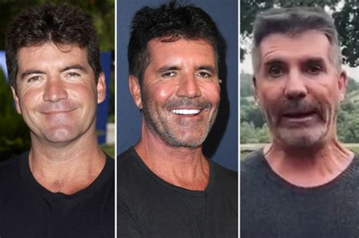 Simon Cowell's Mysterious Illness: A Health Scare or Something More?
